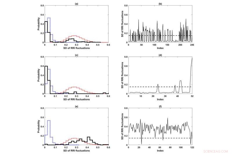 Critical Transition Theory Detects Heart Flickering Before Atrial Fibrillation