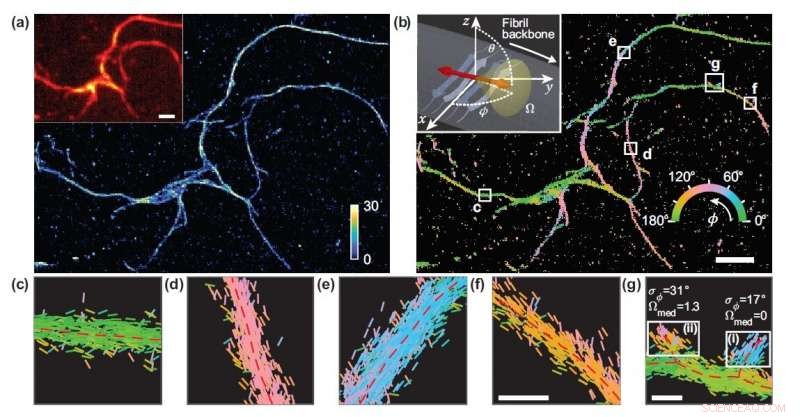 Groundbreaking Microscopy Technique Reveals Amyloid Protein Structures in Unprecedented Detail