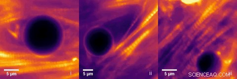 Implanted Microlasers Offer Real‑Time Cardiac Monitoring