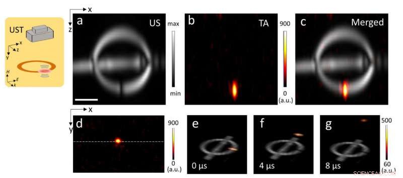 Microwave‑Powered Ring Generates Wireless Ultrasound Pulses