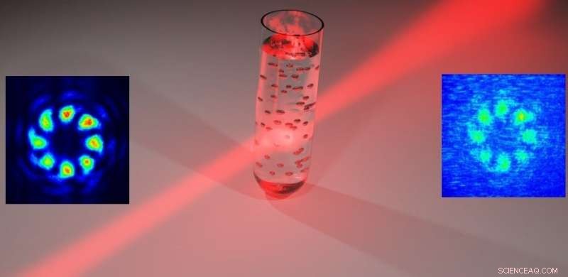 Exploring Quantum Body Scanning: How Vector Vortex Beams Interact with Scattering Media