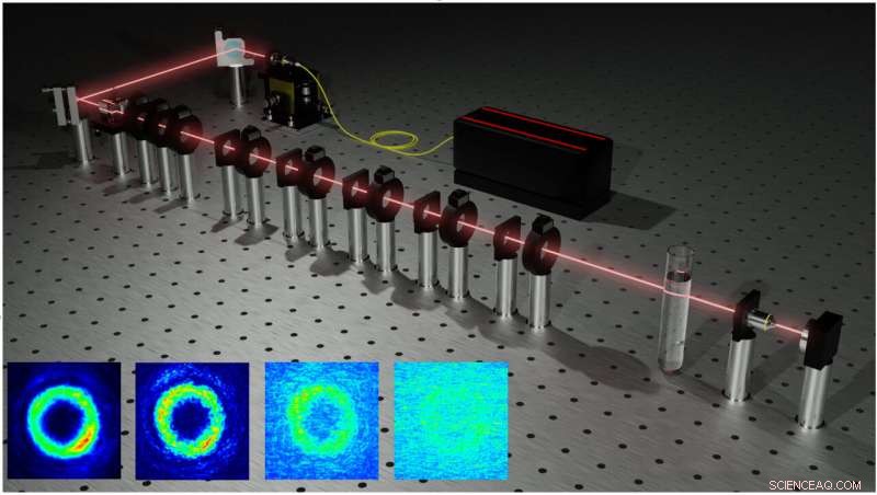 Exploring Quantum Body Scanning: How Vector Vortex Beams Interact with Scattering Media