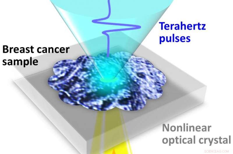 Terahertz Imaging Reveals Early-Stage Breast Cancer Without Staining