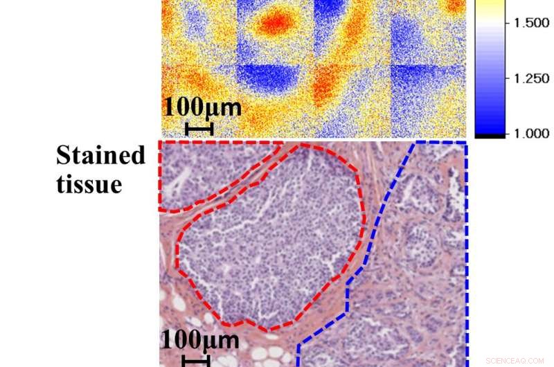 Terahertz Imaging Reveals Early-Stage Breast Cancer Without Staining