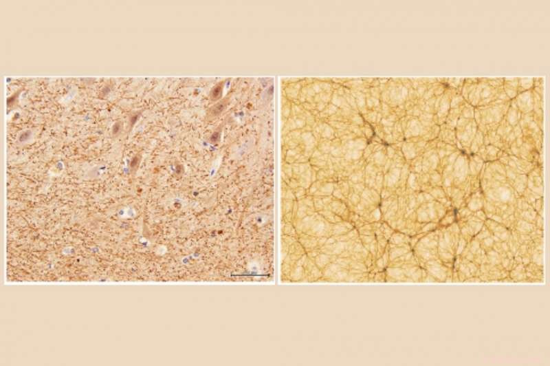 The Brain‑Universe Connection: Are Their Structures Really Similar?