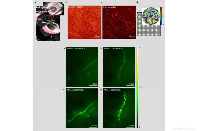 Revolutionary Microscope Enables Imaging Through Intact Skull
