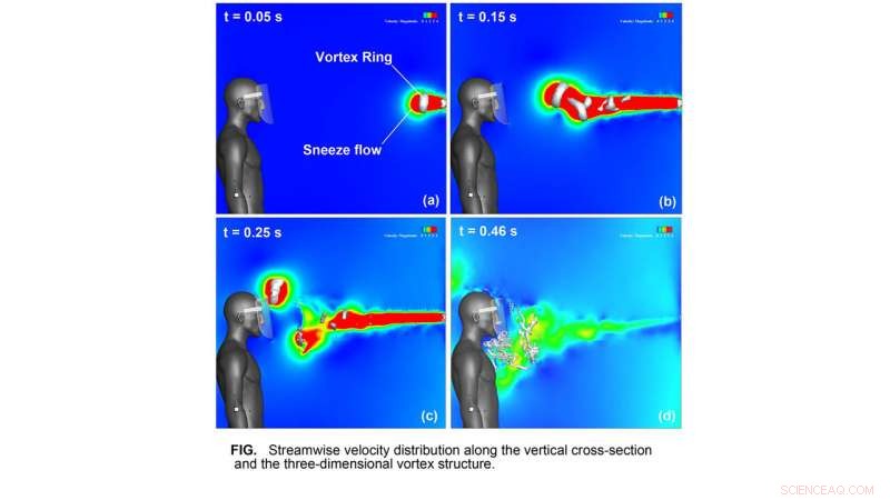 Face Shields Fall Short Against Sneeze Vortex Rings: The Science Behind Their Limitations