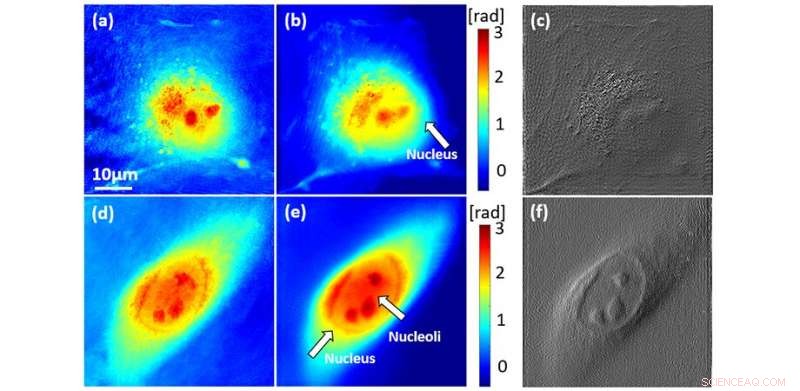Advancing Synthetic Aperture Microscopy: A New Era of Precision Imaging