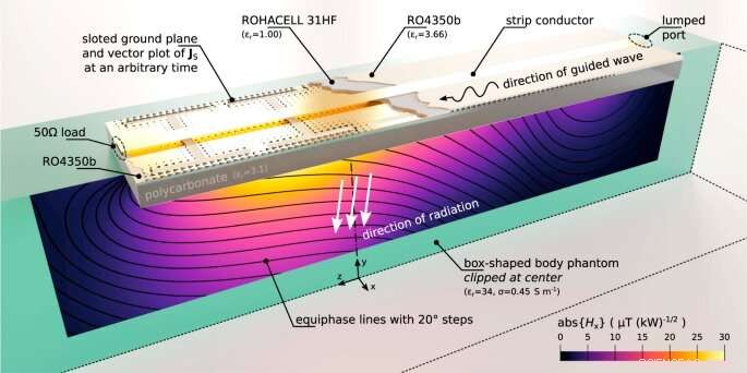 Physicists Design Novel Antennas to Boost MRI Quality and Safety