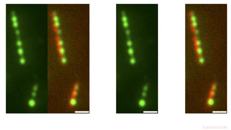 Spiderweb Dewdrops Reveal the Physics Shaping Cell Structures