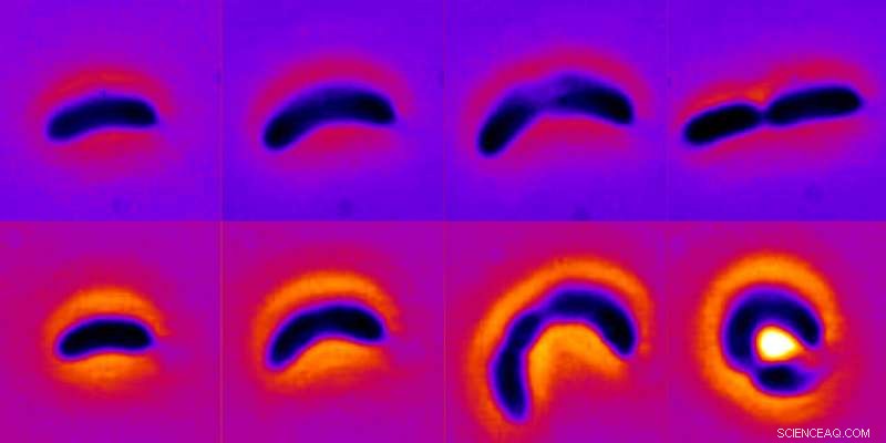 Shape-Shifting Bacteria Boost Antibiotic Resistance