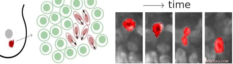 Tumor Fluid Dynamics: How Cancer Cells Mobilize Through Dense Tissue