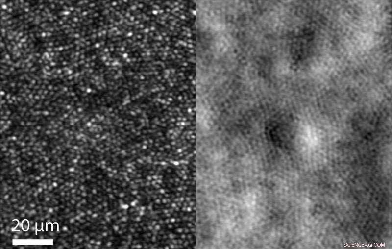 Breakthrough: Researchers Achieve Unprecedented Resolution in Human Eye Imaging