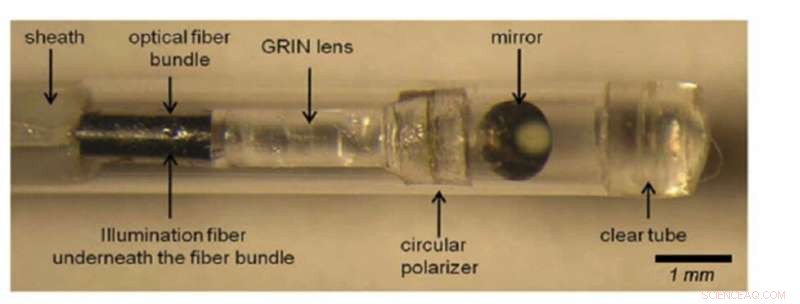 Advanced ILSI Imaging System Predicts High-Risk Plaques to Prevent Heart Attacks
