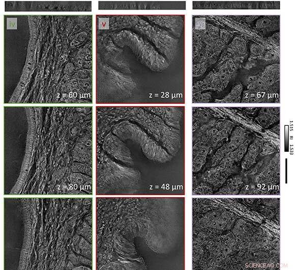 Holographic Histopathology: Rapid, Precise Diagnostics for Pathological Tissue