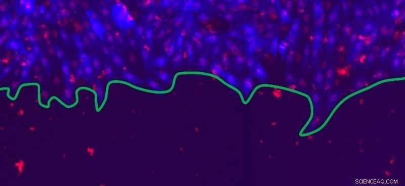 Physics Insights into the Wound Healing Process