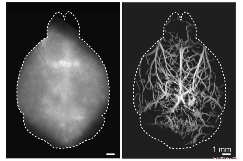 Revolutionary Microscopy Technique Delivers Deeper Insight into the Living Brain