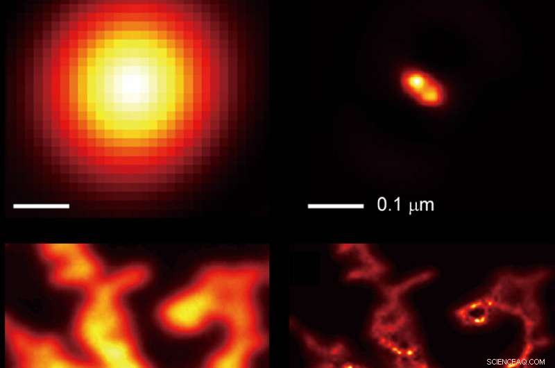 New Light‑Shrinking Material Enables Super‑Resolution Imaging on Standard Microscopes