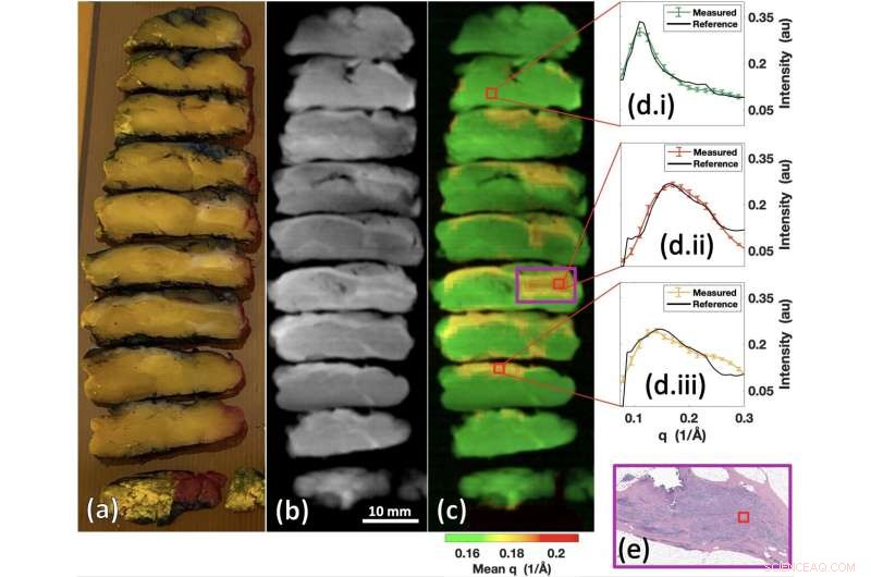 Duke s X‑ray Scanner Detects Cancer & Analyzes Drugs in Minutes