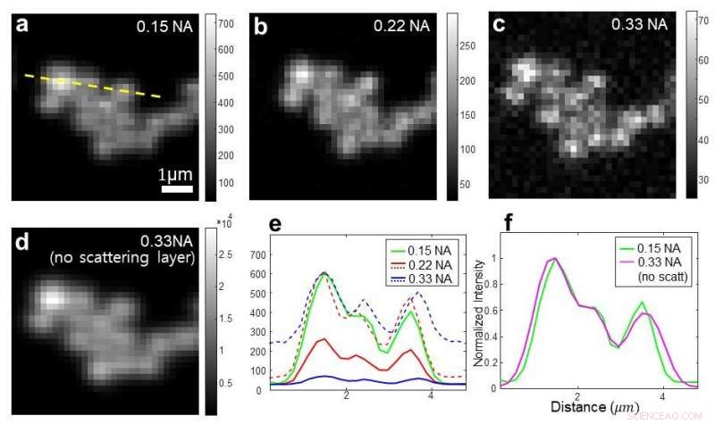 Enhancing Deep Optical Microscopy for Superior Biological Tissue Imaging