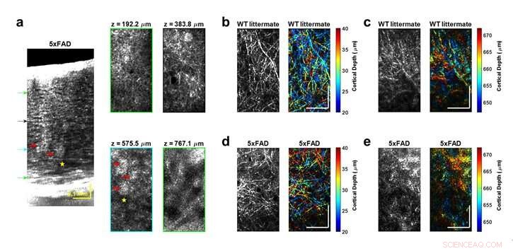 Advanced Non‑Invasive, Label‑Free Optical Imaging Reveals Deep Cellular Brain Pathology In Vivo