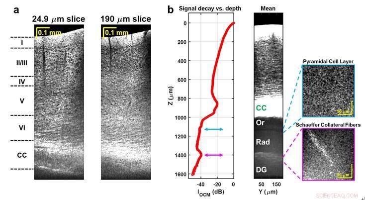 Advanced Non‑Invasive, Label‑Free Optical Imaging Reveals Deep Cellular Brain Pathology In Vivo