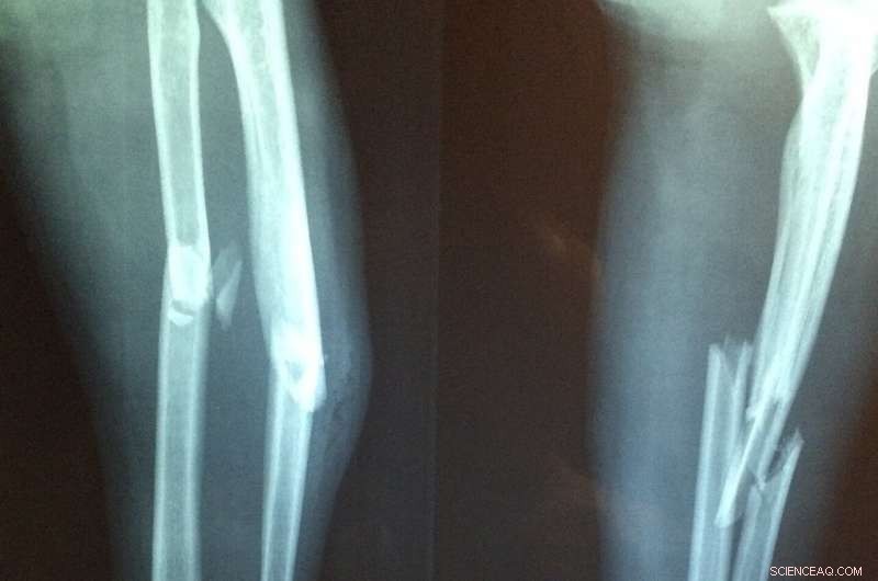 Revolutionizing X‑Ray Imaging: Deep Learning Brings 3D Visualization