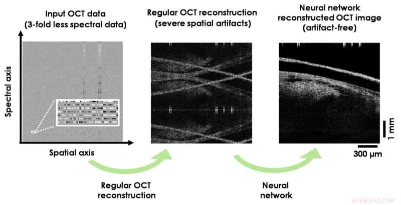Deep Learning Enhances OCT Image Reconstruction with Less Data