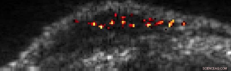 Acoustic Imaging Reveals Single Cells Inside Living Organisms