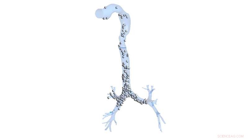 Computational Analysis Reveals Opportunities to Enhance Inhaler Performance