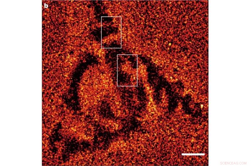 Revolutionizing Chemical Imaging: A Novel Super‑Resolution Microscopy Technique