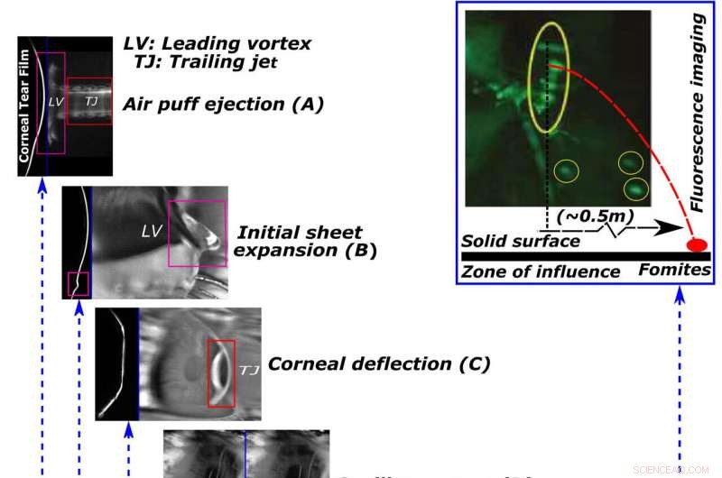 Routine Eye Test Reveals Tear Droplets Can Spread Viruses – A Non‑Invasive Study