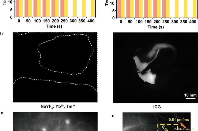 Enhancing Anti-Stokes Bioimaging with Indocyanine Green Hot-Band Absorption