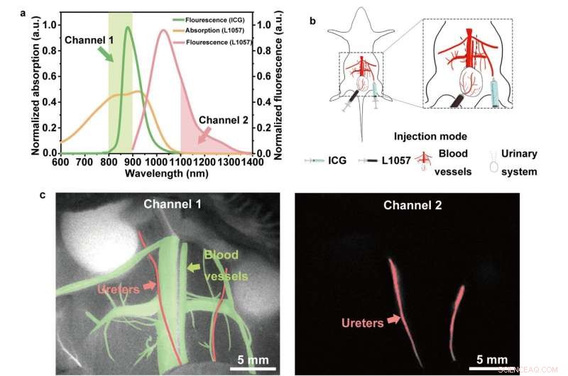 Enhancing Anti-Stokes Bioimaging with Indocyanine Green Hot-Band Absorption