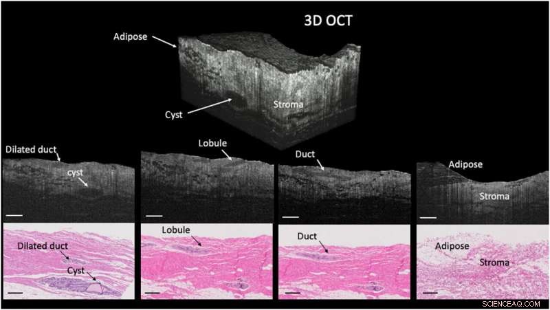 Millimeter-Scale Chip-Based Supercontinuum Generation: Compact, High-Performance Light Source