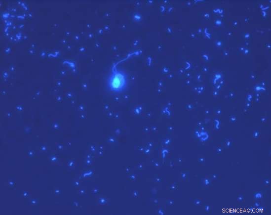 Scientists Measure Bacterioplankton Carbon Uptake to Unlock Ocean Carbon Cycle Secrets