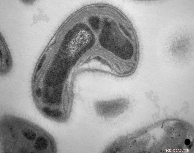 Microbial Breakthrough: New Process Promises to Lower Toxic Methylmercury Levels