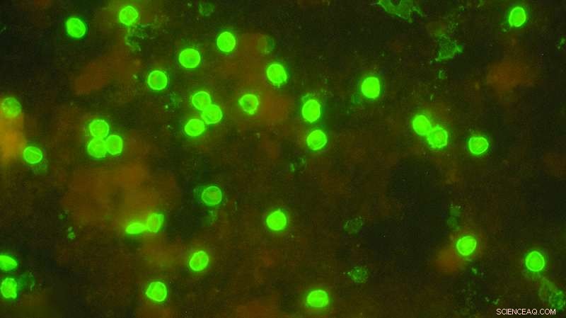 The Prevalence of Protozoa in Drinking Water: What You Need to Know