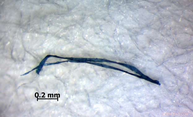 First Evidence of Microplastic Ingestion in Deep-Sea Bottom-Dwellers
