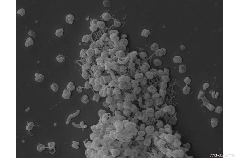 New Microbe Discovery Offers Hope for Restoring Earth s Nitrogen Balance