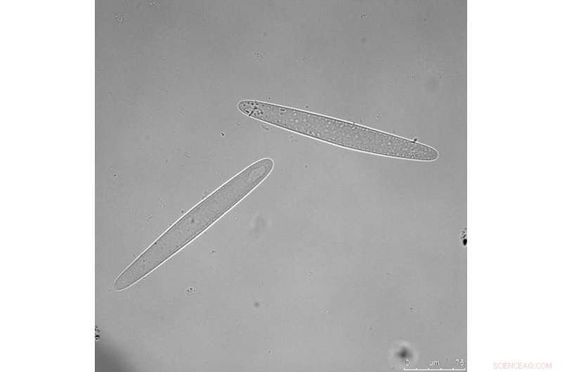 Giant Symbiotic Bacteria Enable Red Sea Surgeonfish to Specialize Their Diets