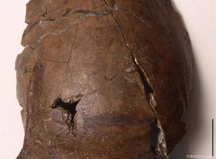 New Findings Reveal 6000‑Year‑Old Skull as Likely Victim of the World’s Oldest Tsunami