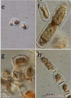 Algae Growth Diminishes Greenland Ice Sheet Reflectivity, Accelerating Melt Rates
