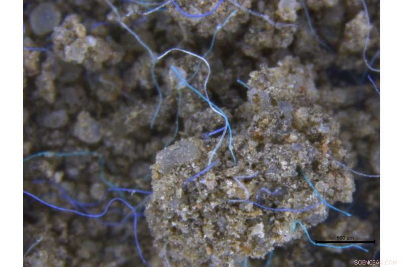 Microplastics in Terrestrial Ecosystems: An Underestimated Threat to Wildlife and Soil Health