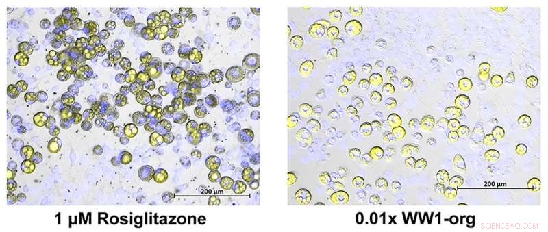 Fracking Wastewater Exposure Promotes Fat Cell Formation, New Study Finds
