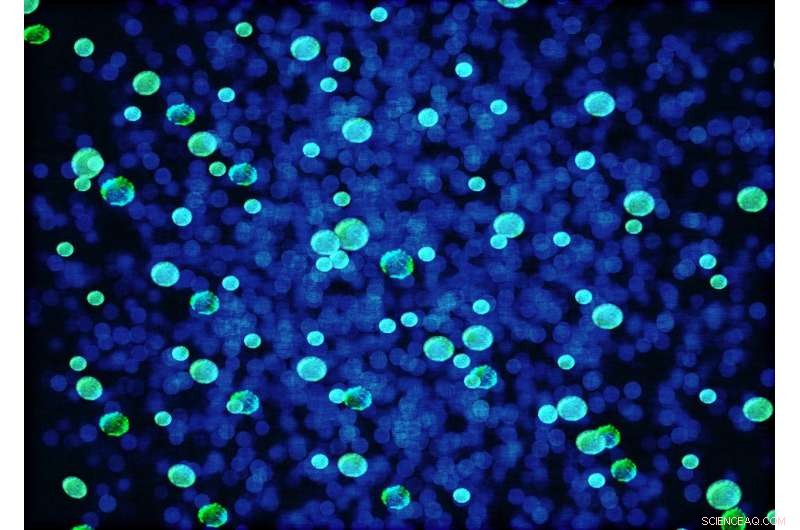 Methane-Producing Microbial Communities Discovered in Fracking Wells: Implications for Energy, Health, and Science