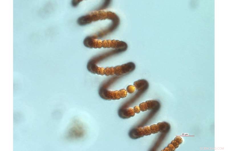 Cutting Nitrogen Inputs Stops Algal Blooms in Lakes