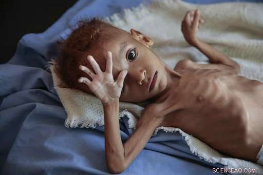 UN Report: Fragile Climate Threatens Global Food Security