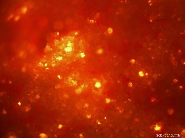 Laundry Washing: The Hidden Source of Microplastic Pollution