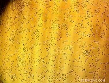 Toxic Selenium Aerosols Threaten Health of Agricultural Residents